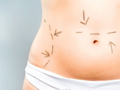 SEXUALITY: Η πλαστική χειρουργική είναι αναγκαία σε όλες τις ηλικίες;